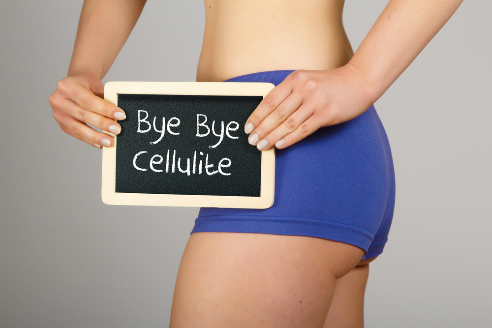 Cellulite Rimedi naturali