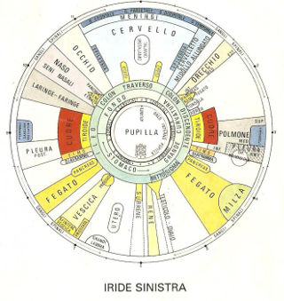 Iride sinistra- Consulenza iridologica